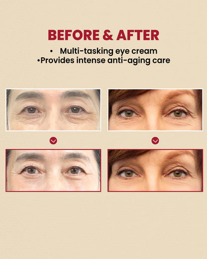 K-SECRET SEOUL 1988 Eye Cream : Retinal Liposome 4% + Fermented Bean