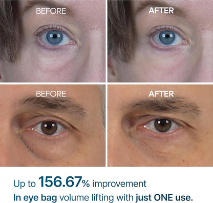 Dr.Melaxin Eyephalt Eyebag Cream for Puffiness, Dark Circles & Fine Lines, Wrinkle, EGF Anti-Aging Under Eye Moisturizer with Niacinamide &Ceramide 0.33 fl.oz.