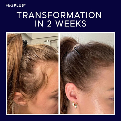 FEG® Advanced Hair Growth Spray – Revitalize Roots & Boost Thickness