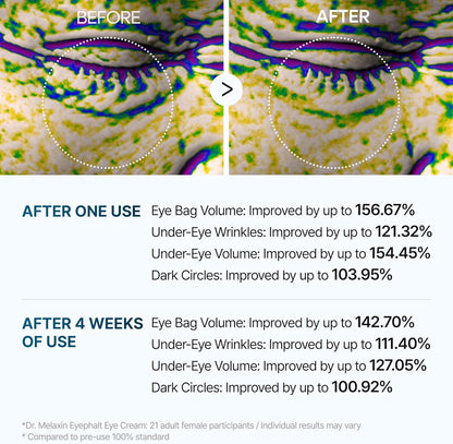 Dr.Melaxin Eyephalt Eyebag Cream for Puffiness, Dark Circles & Fine Lines, Wrinkle, EGF Anti-Aging Under Eye Moisturizer with Niacinamide &Ceramide 0.33 fl.oz.