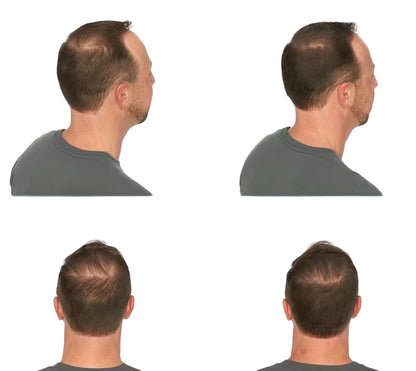 LED Hair Light Growth Cap ⭐⭐⭐⭐⭐