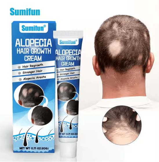 Sumifun Alopecia Hair Growth Cream 20g⭐⭐⭐