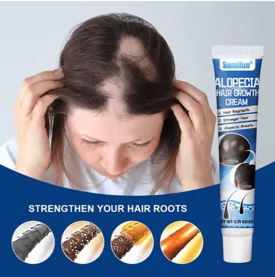 Sumifun Alopecia Hair Growth Cream 20g⭐⭐⭐